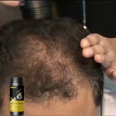 ショウガ育毛パウダー